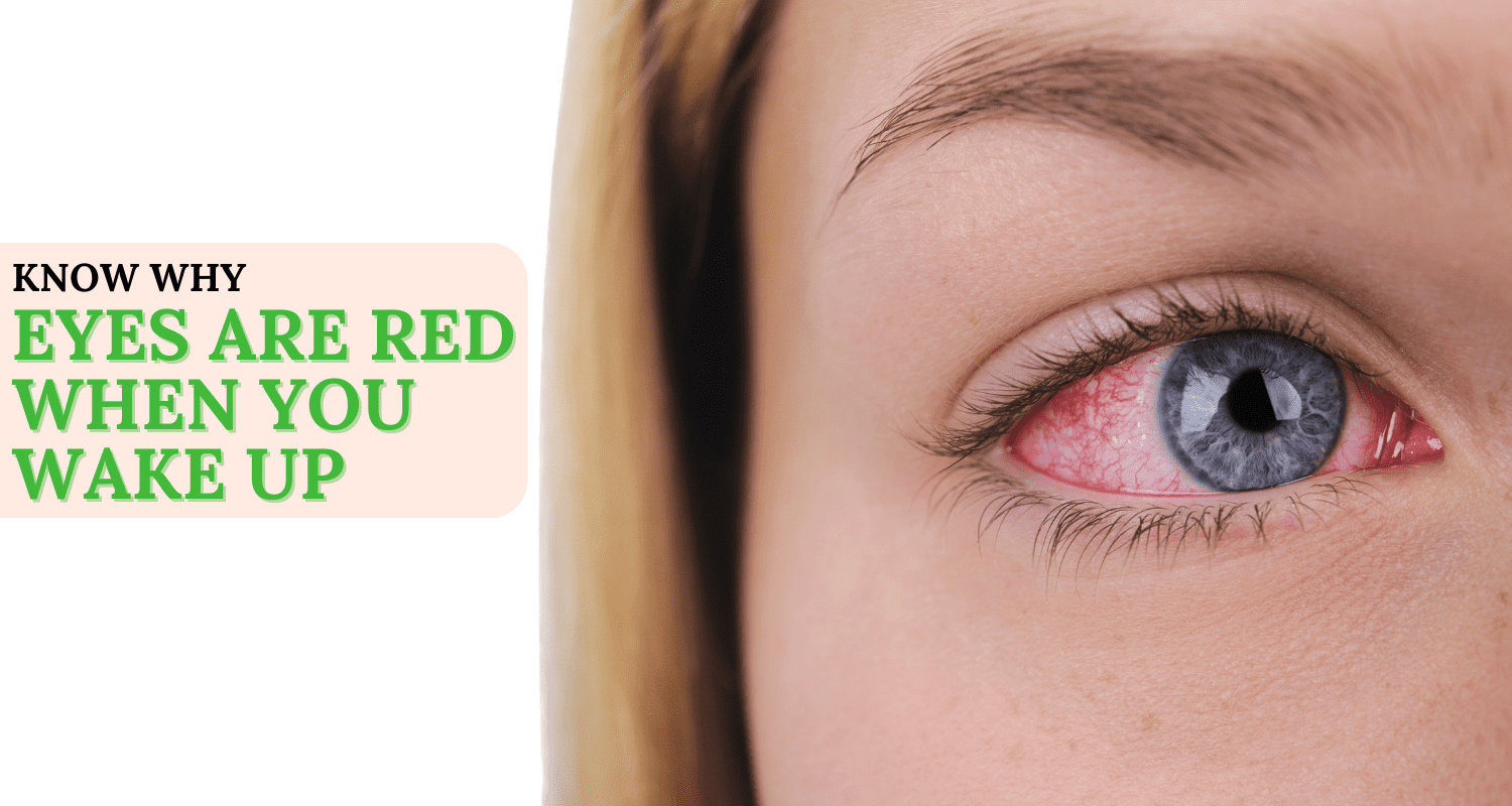 Why Are My Eyes Red When I Wake Up? Causes, Remedies & When to Worry
