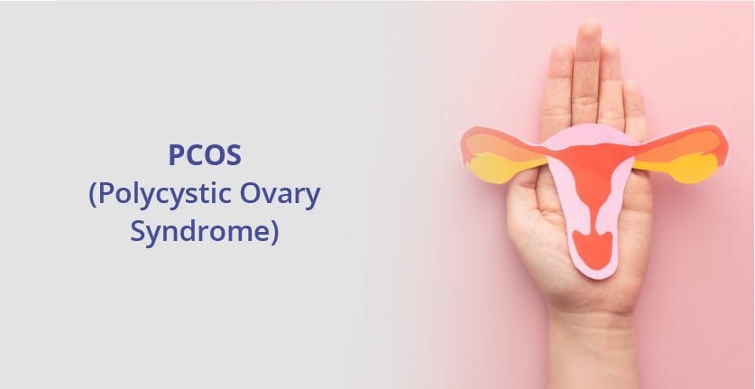 PCOS Symptoms Checklist: Signs You Might Have Polycystic Ovary Syndrome