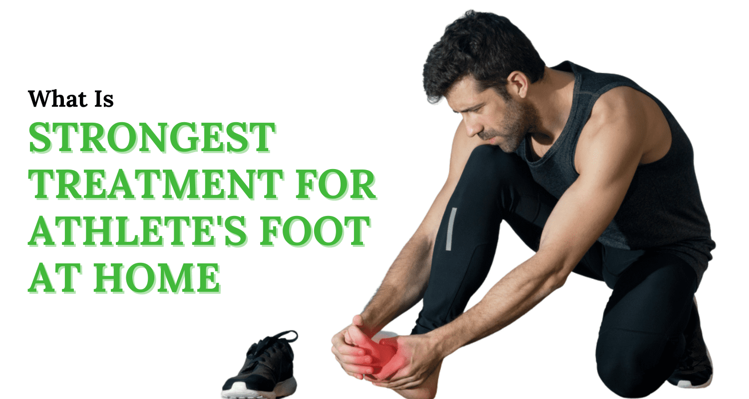 What Is the Strongest Treatment for Athlete’s Foot at Home?
