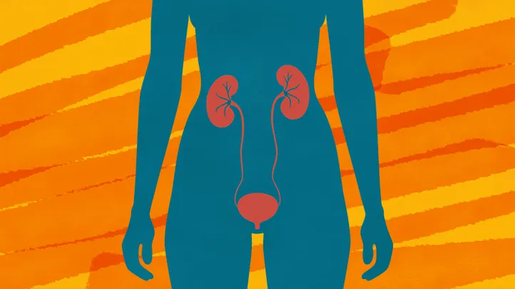 Recurring UTIs in Women: Why They Keep Coming Back (and How to Stop Them)