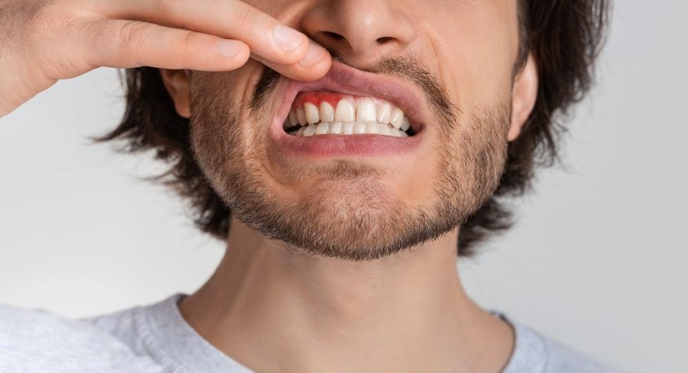 Gum Disease and Heart Disease: The Surprising Link Your Dentist Knows