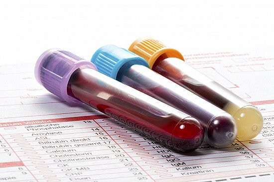 How to Read Your Blood Test Results: What Every Number Actually Means