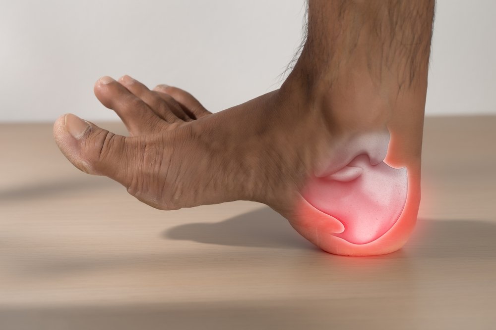 Plantar Fasciitis: The Real Reason Your Heel Hurts (and How to Fix It)