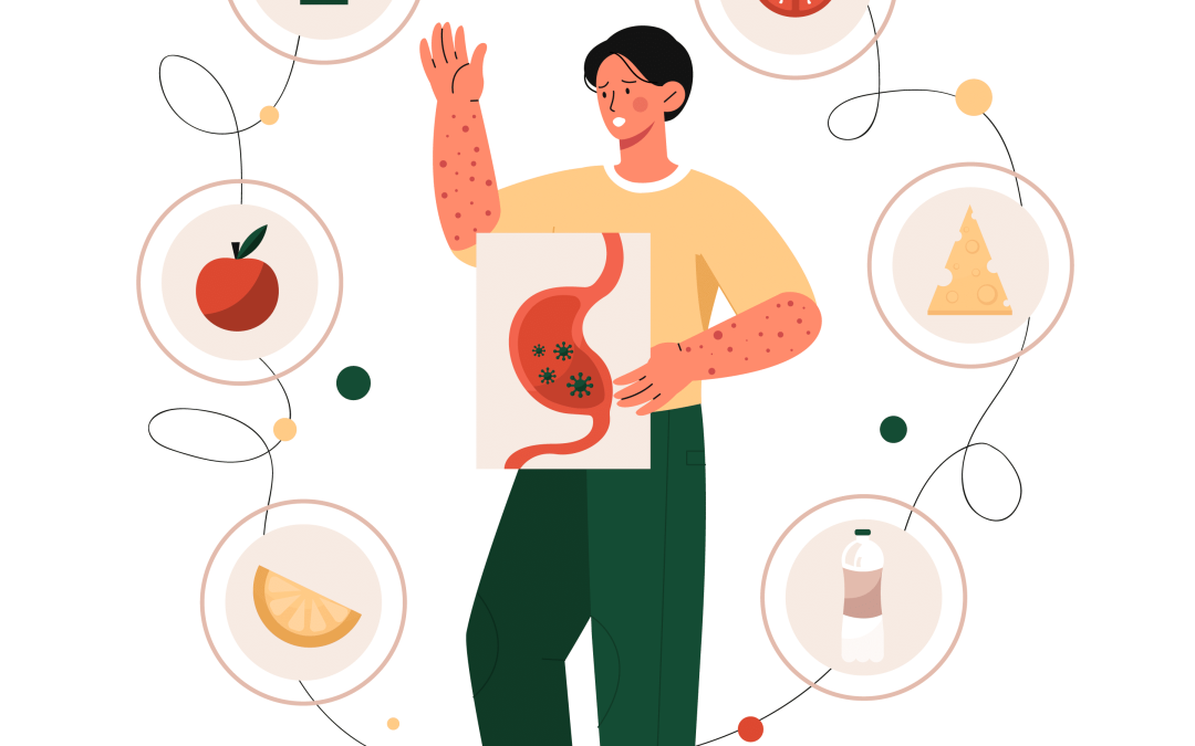 Histamine Intolerance Symptoms: The Hidden Cause of Mystery Reactions