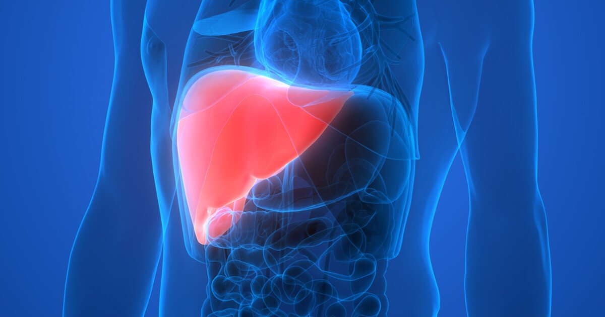Non-Alcoholic Fatty Liver: The Silent Epidemic Affecting 1 in 4 Americans