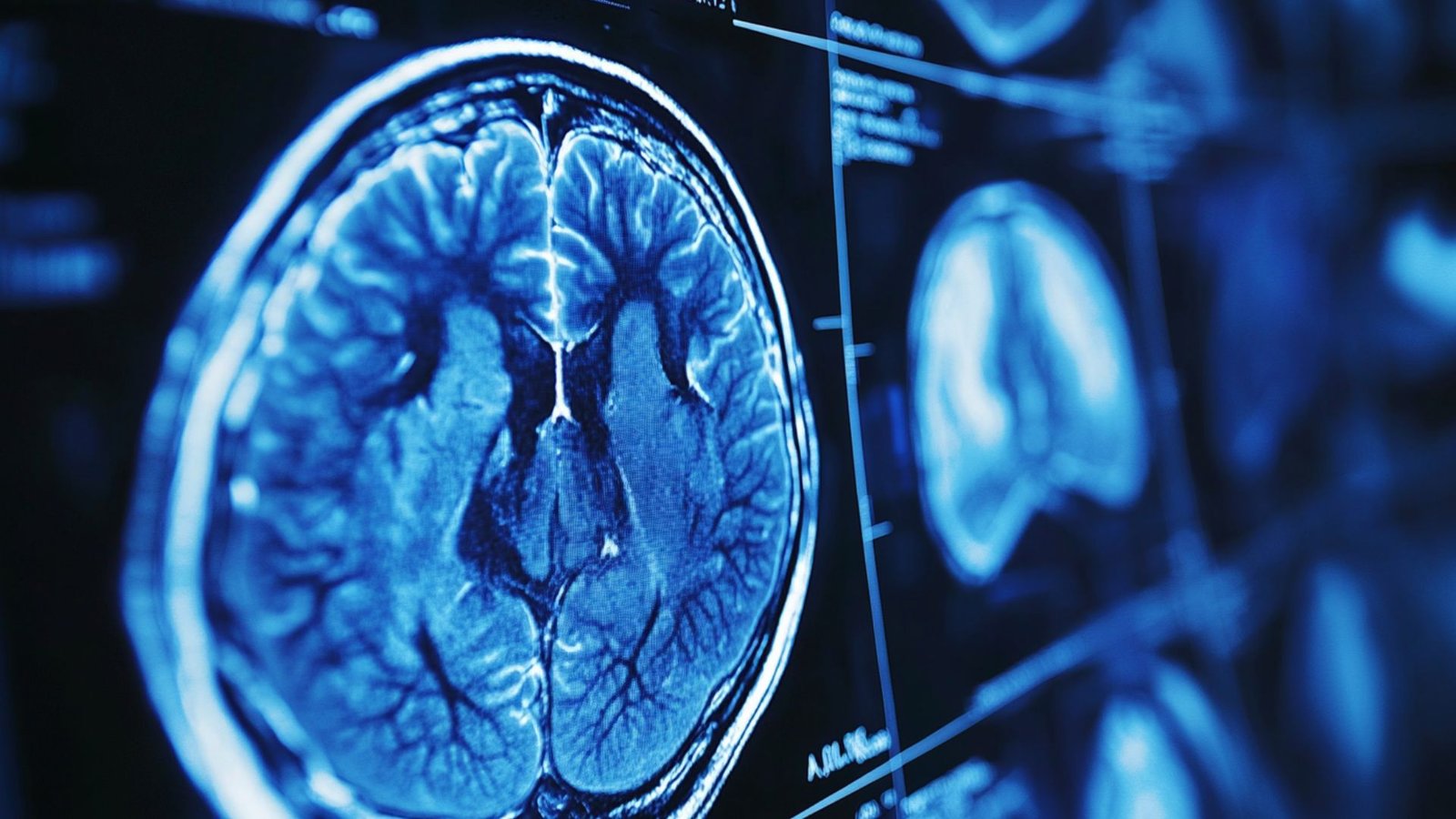FAST Stroke Warning Signs and What to Do in the First 60 Minutes
