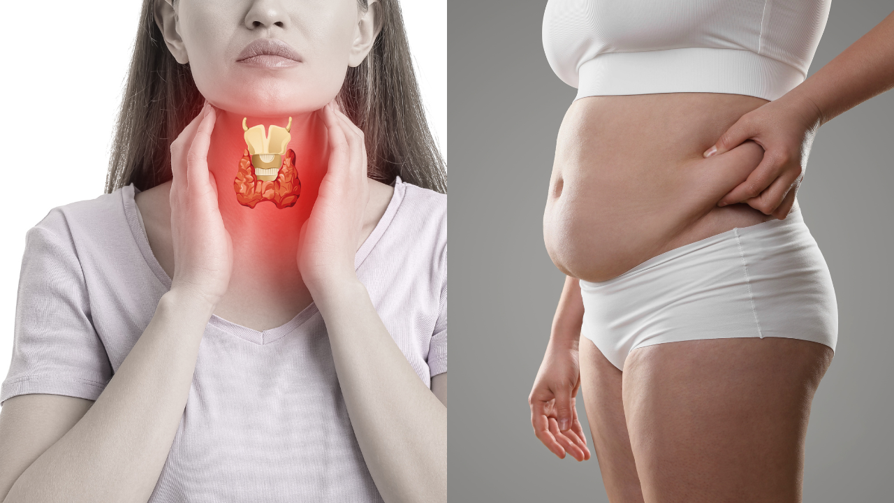 How to Lose Weight With Hypothyroidism: What Actually Works