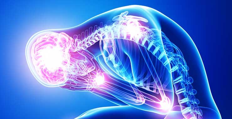 How Stress Causes Physical Pain: The Mind-Body Connection Explained