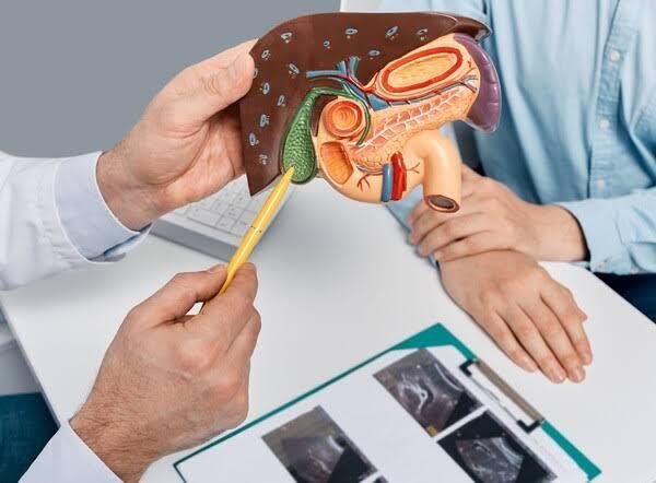 Gallstones Symptoms: How to Know If You Have Them Before a Crisis
